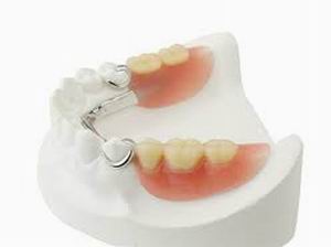 Remove  partical denture